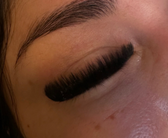 Mega Volume Fill