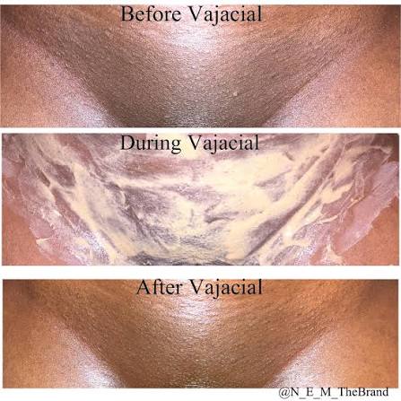 Vajacial at Shay’s Peaceful Escape, LLC in San Antonio, TX