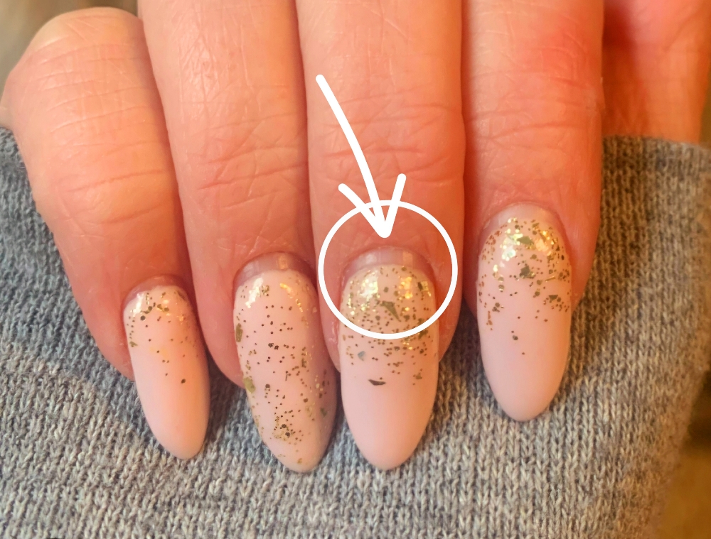 Enhancement Fill