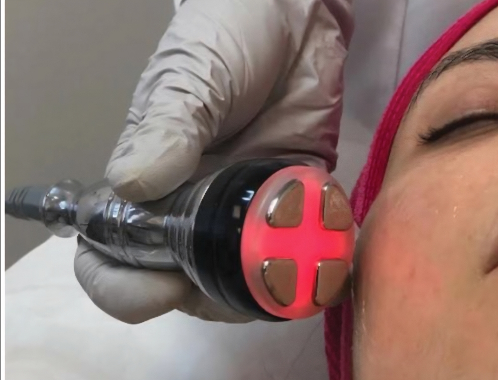 Radio-frequency Add On