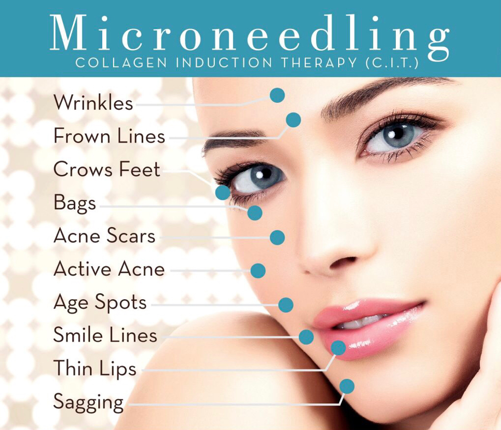 Micro- Needling Mastery  Trianing
