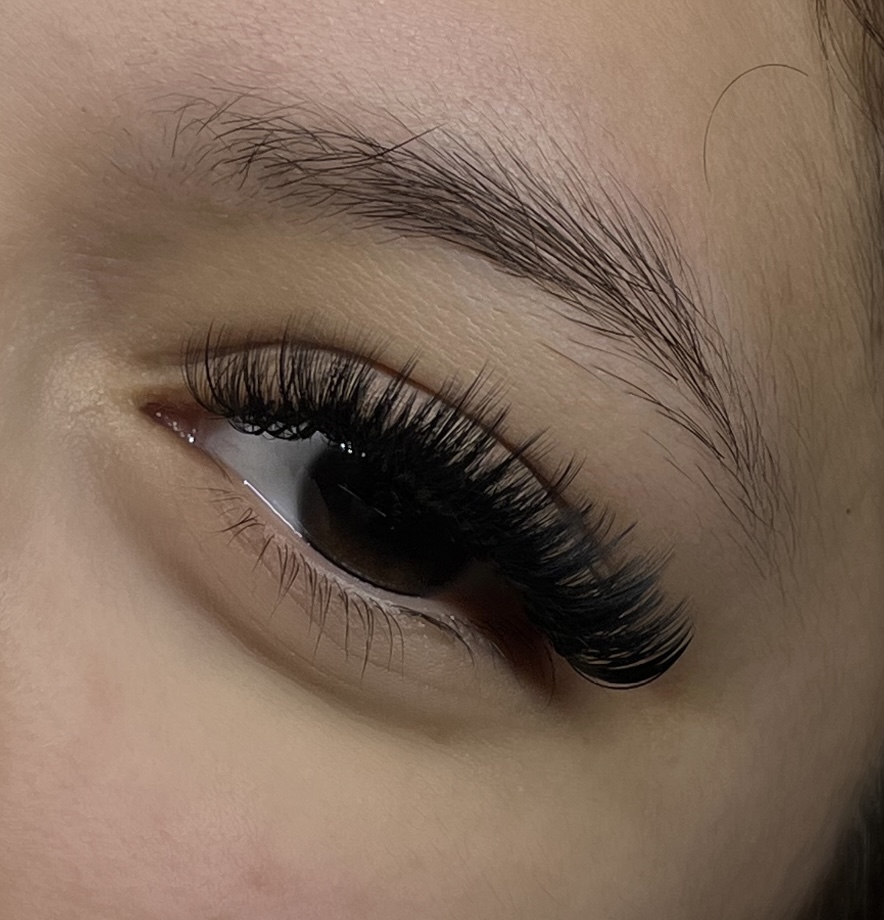 Light Volume Set at Ashxsthetics in Naples, FL