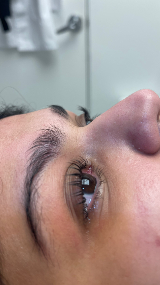 Eye Lash Lift Treatment