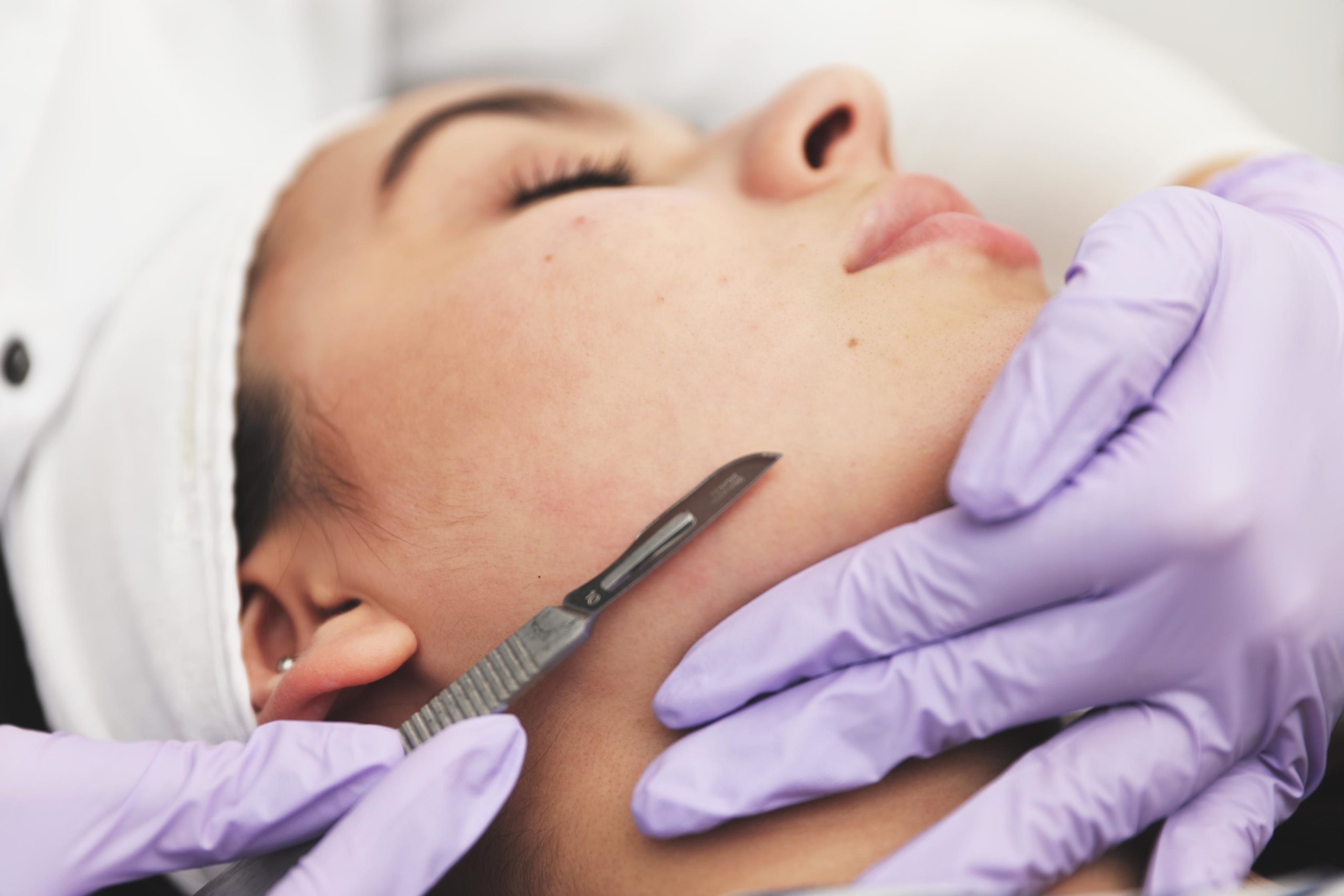 Dermaplaning w/ serum at Get Frosted lux Spa in Wauchula, FL