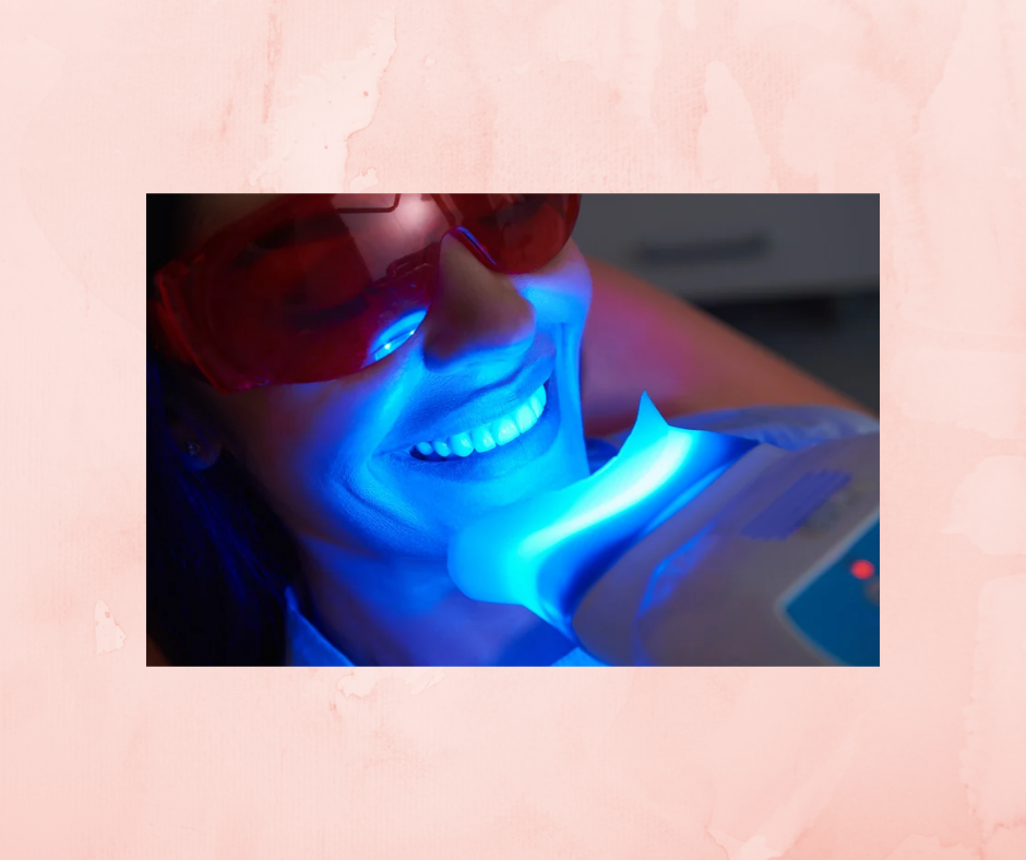 20 Min Teeth Whitening