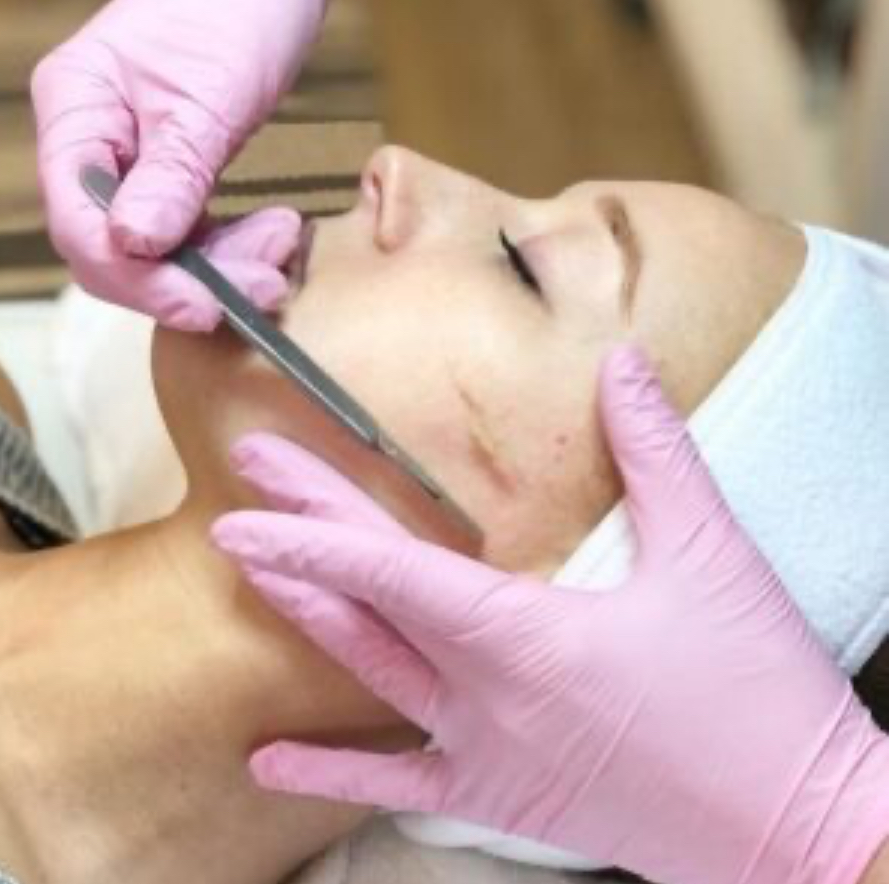 Dermaplaning
