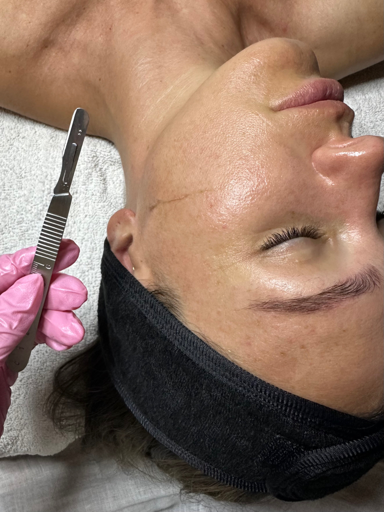 Dermaplane Facial