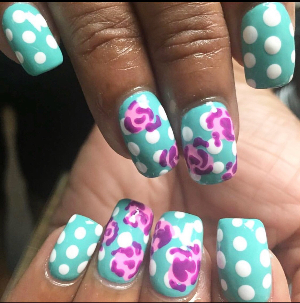STRUCTURED GEL FILL