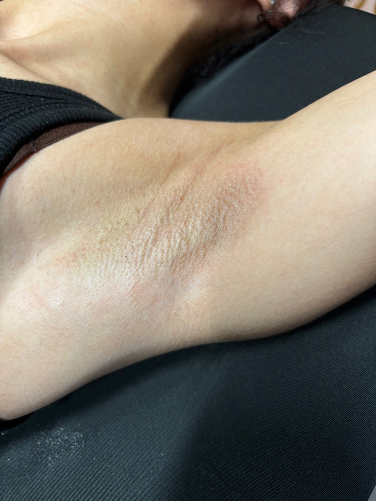 Underarm Wax