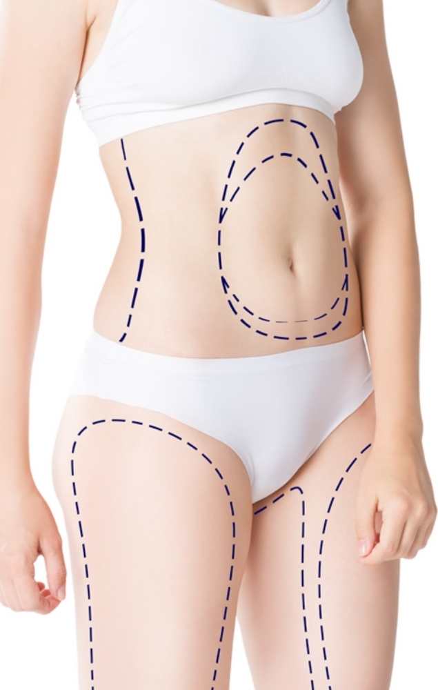 Post-Op Package 10-session