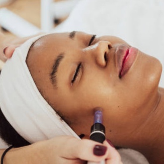 Microneedling therapy at Blossoms HTX Hair Studio in Spring, TX