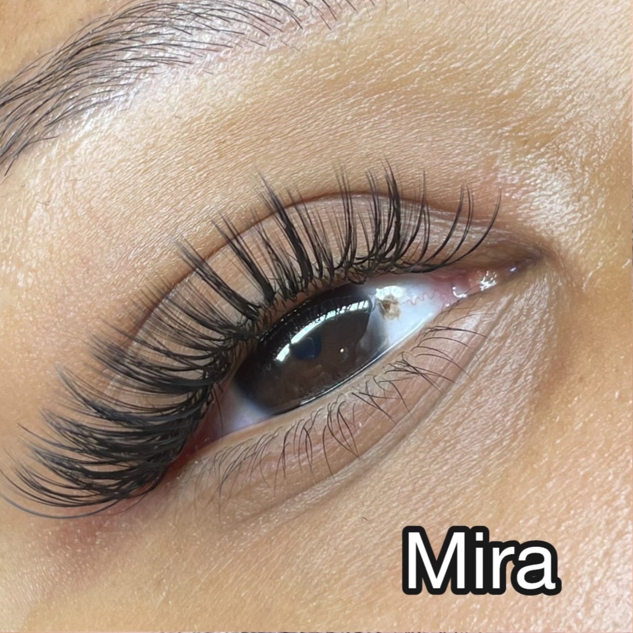 Mira Set at Beon Esthetics in Philadelphia, PA