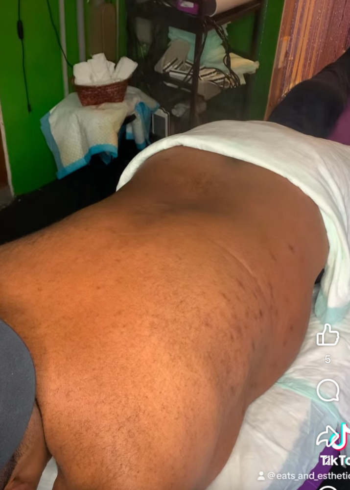 Male Back Wax