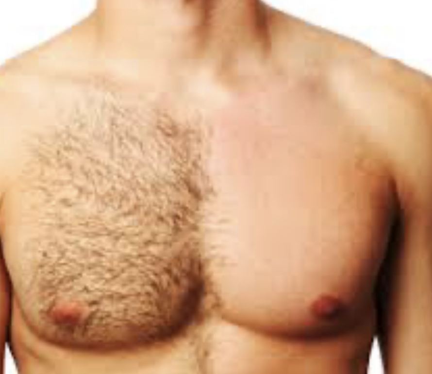 Chest