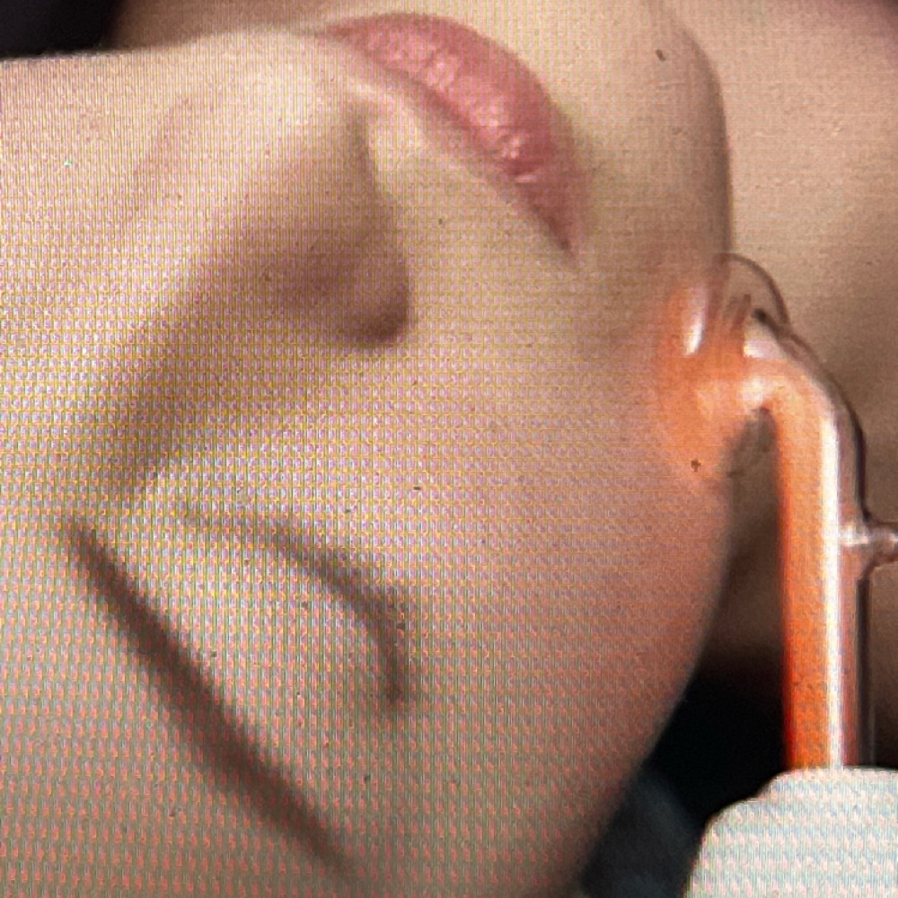 High-Frequency at KTH ESTHETICS in Las Vegas, NV