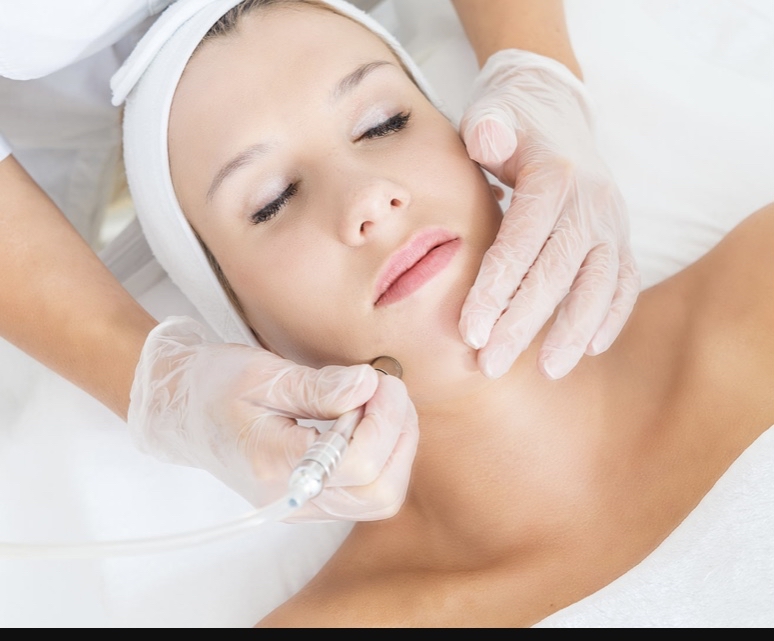Diamond Microdermabrasion