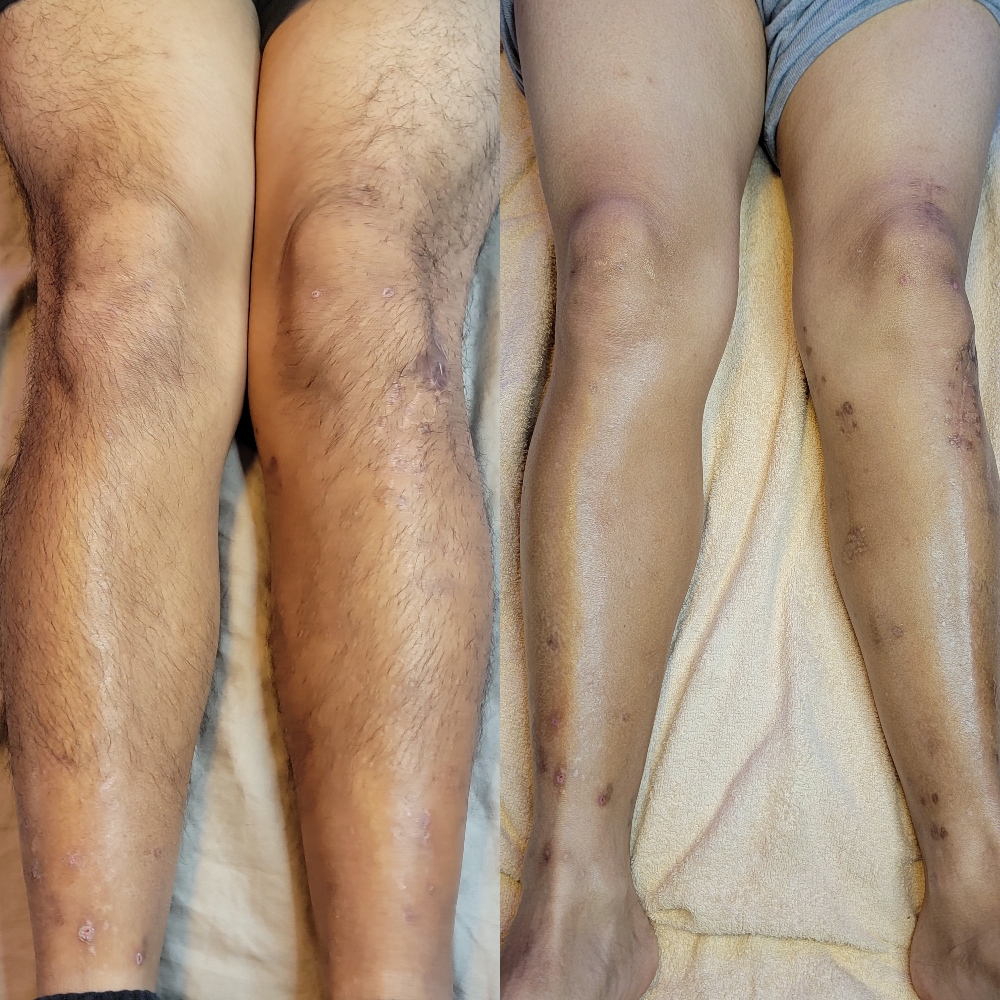 Full Leg Wax