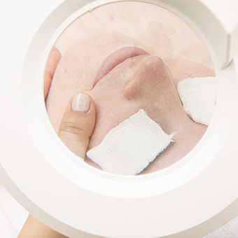 HydroDermabrasion - 60 minutes