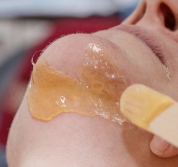 Chin Wax