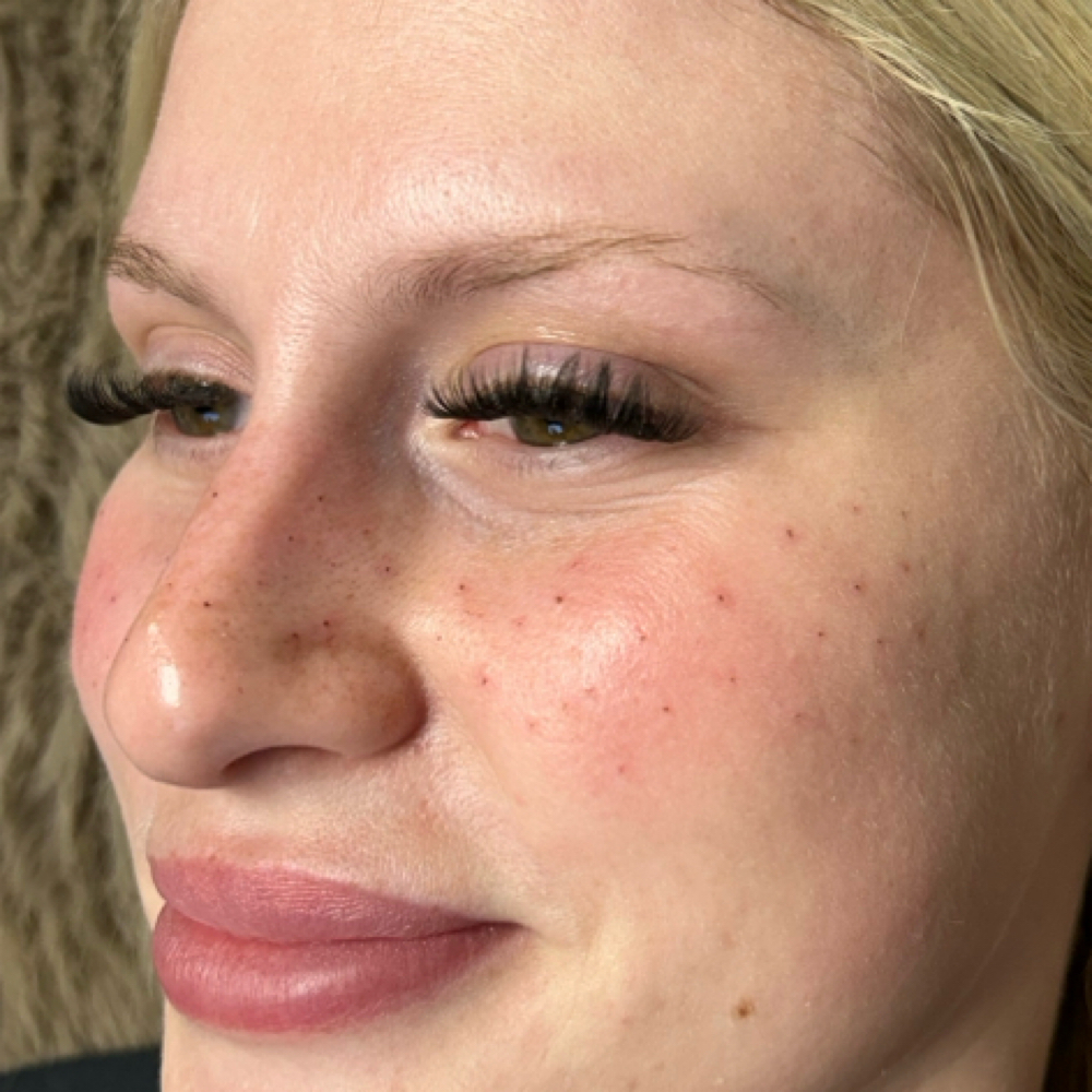 FRECKLE TATTOO - MED COVERAGE at Greta’s Ink n Glam in Cottage Grove, OR
