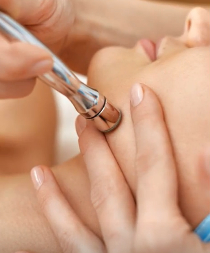 Microdermabrasion Add-On