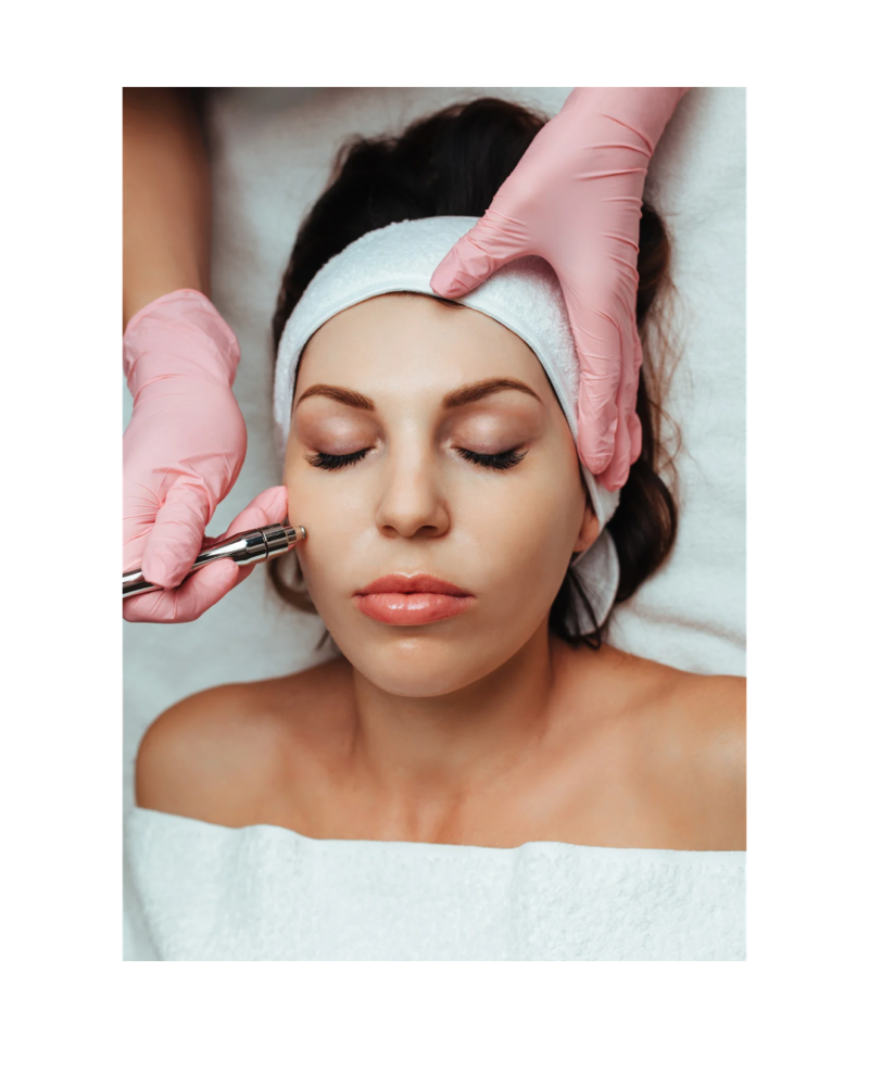 Microdermabrasion Facial