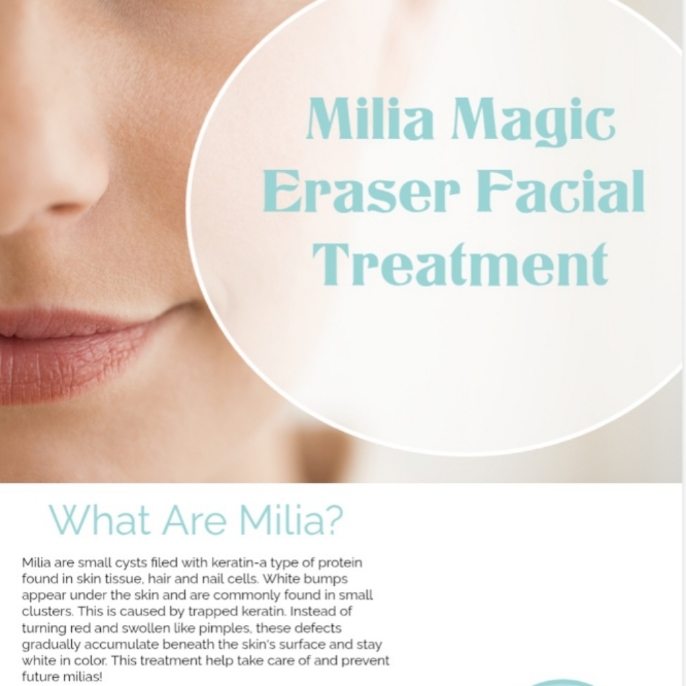 Milia Eraser Facial 💆‍♀️✨️ at N Spa Nails in Denver, NC