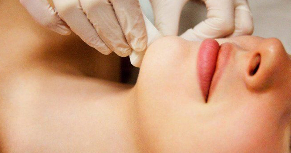 Chin And Cheek Wax
