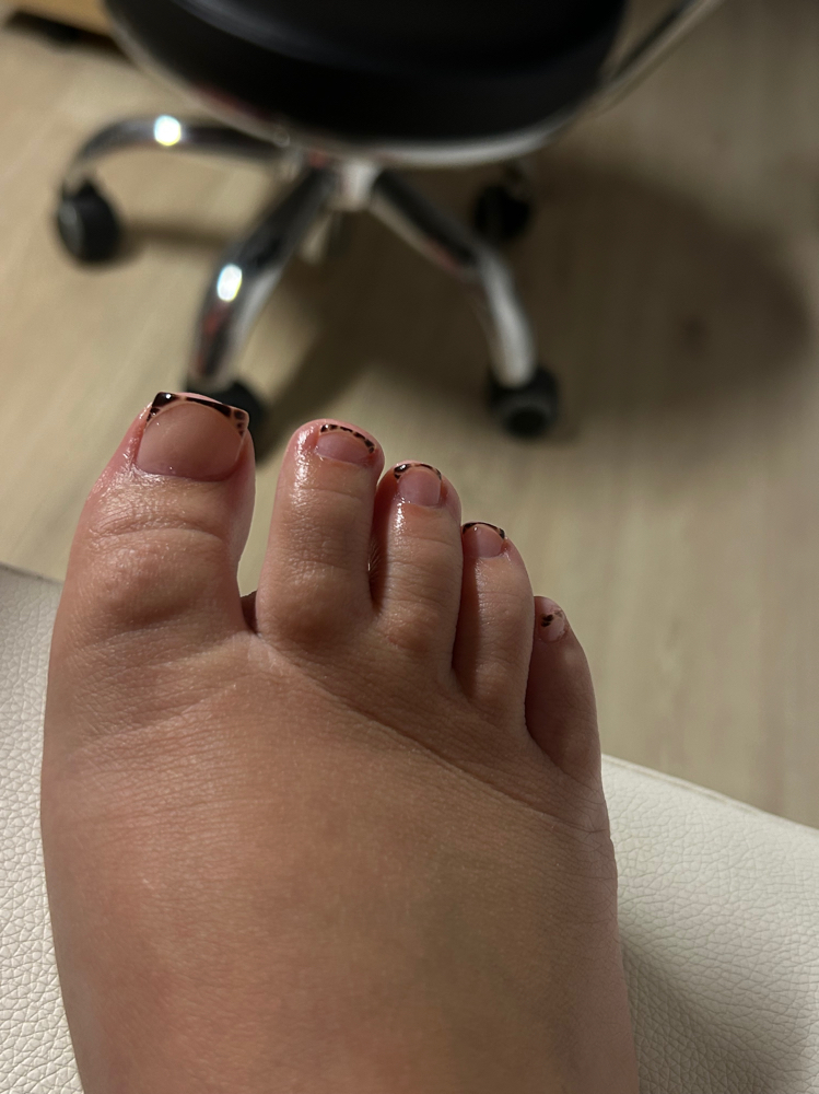 Acrylic On Big Toe