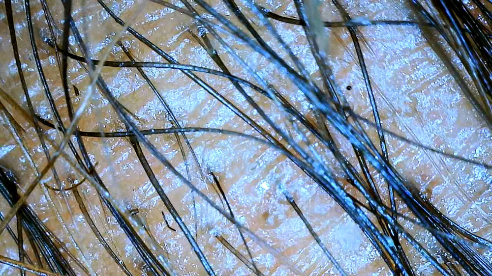 Regrowth Consult & Scalp Analysis