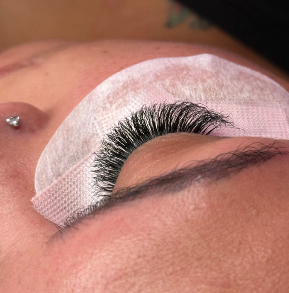 Light Volume Fill at Diverse Esthetics in Depew, NY