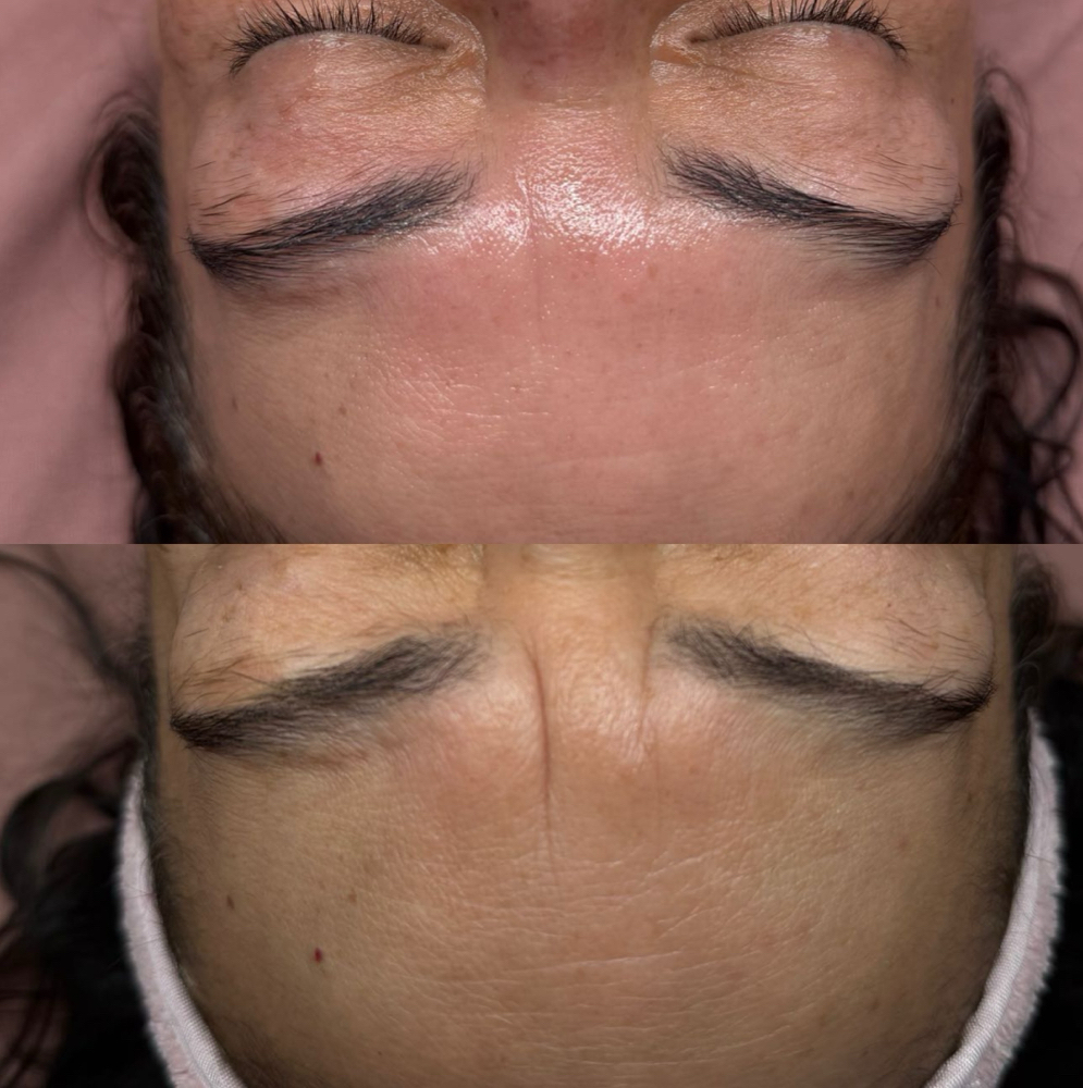 Cereza Custom Experience 🍒 at Cereza Skin and Laser in Tempe, AZ