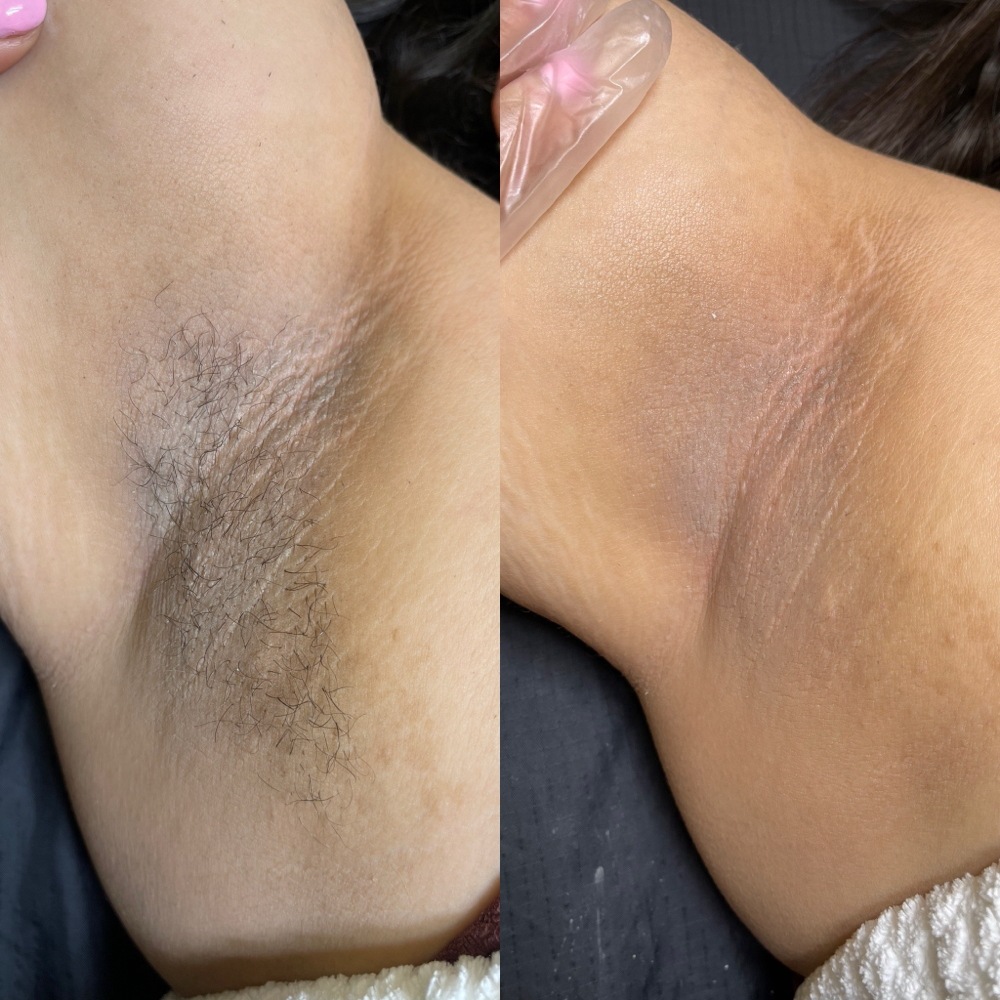 Underarm Wax
