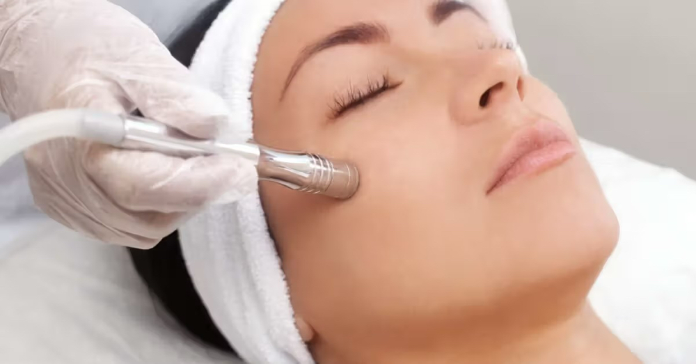 Microdermabrasion