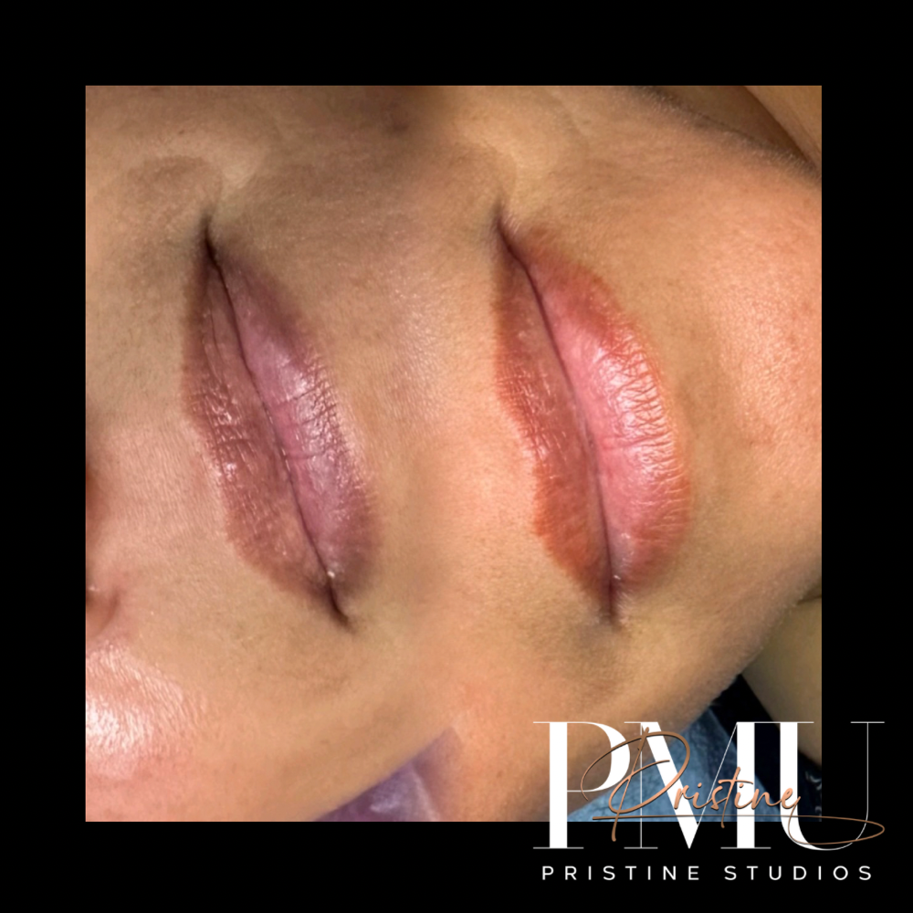Lip Neutralization