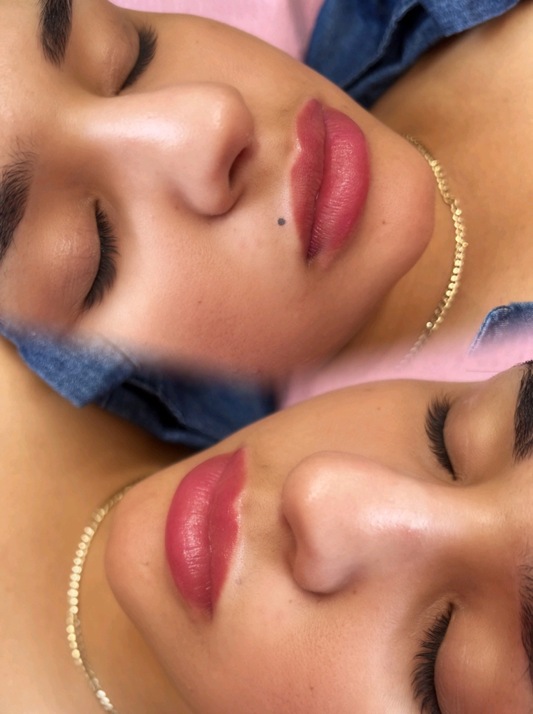 Freckles/Beauty Marks