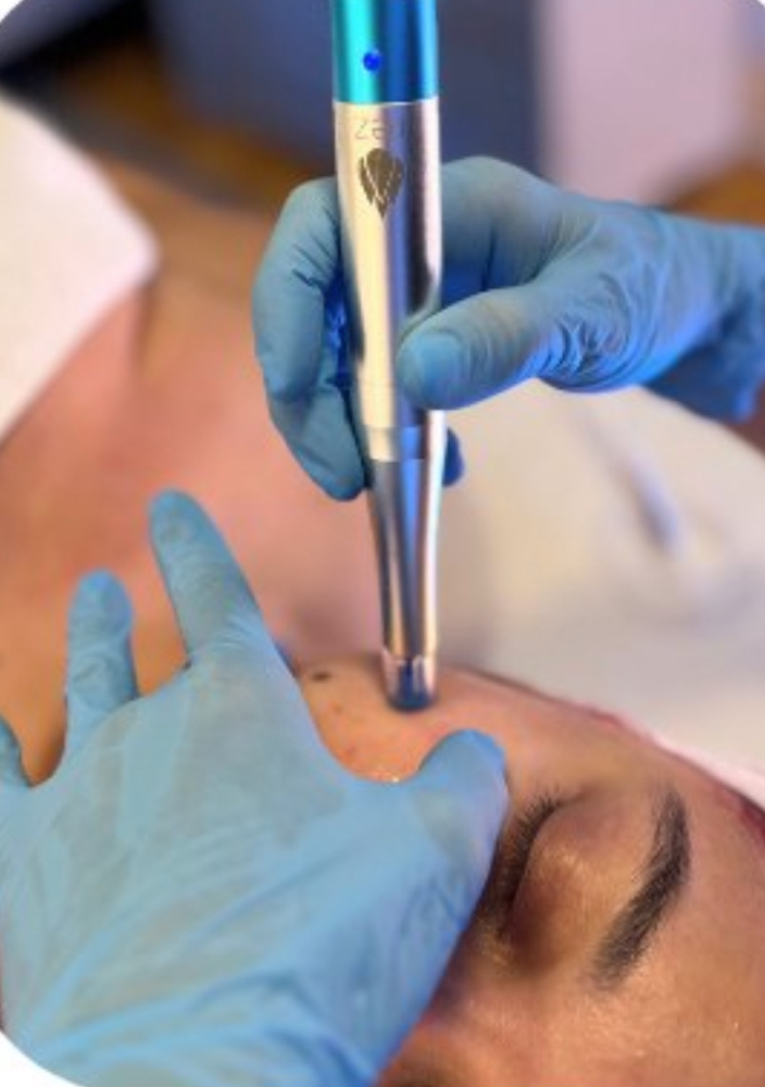 Nano Infusion Facial