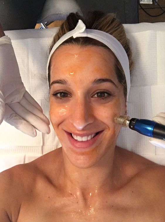 Signature Microneedling Treatment at Jennifer Marie Skincare in Elkhart, IN