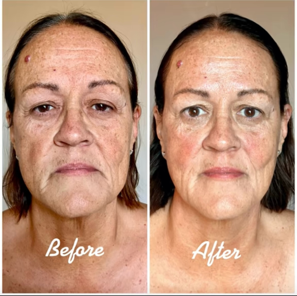 Manual Facelift Massage