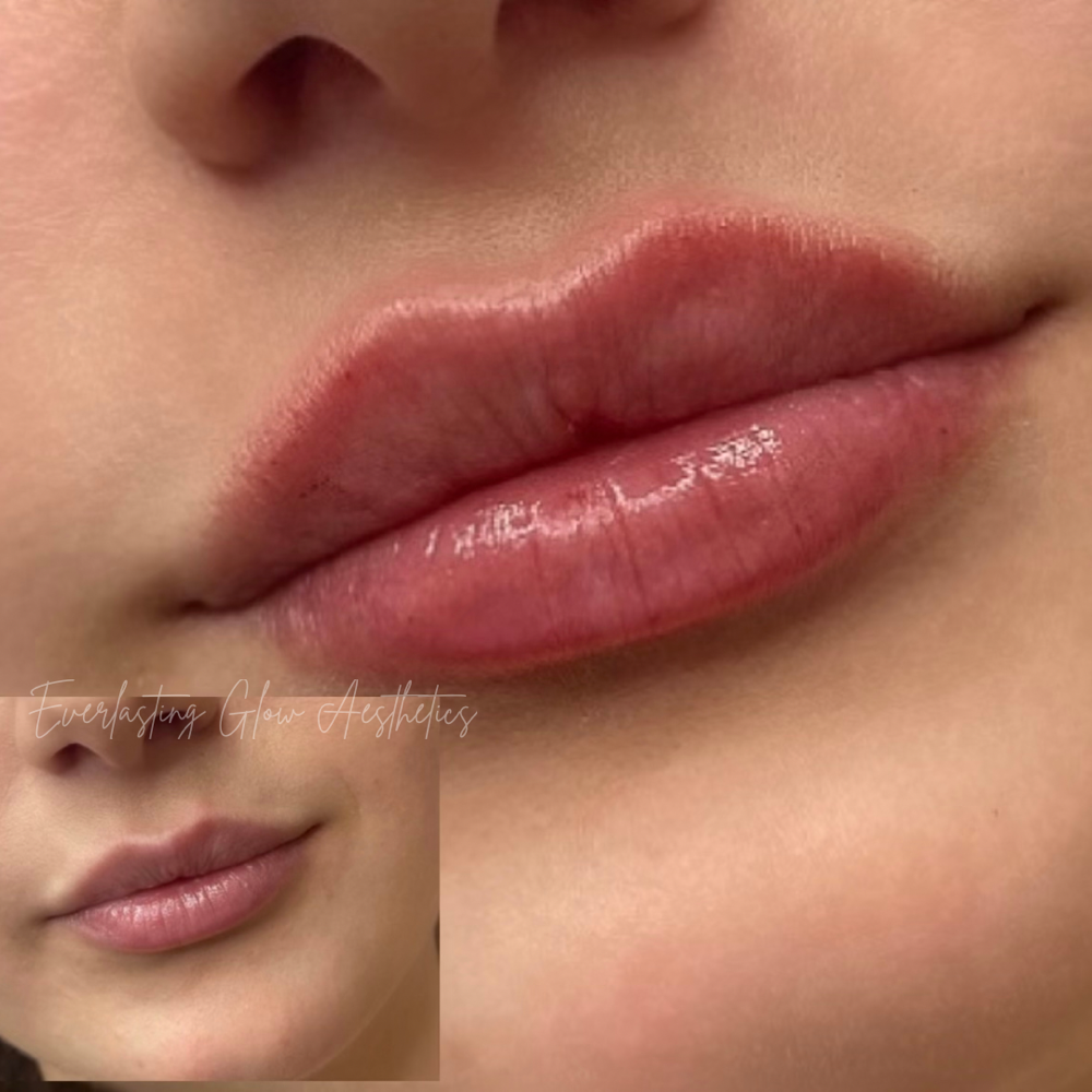 Full Volume Lip Plump (1ml)
