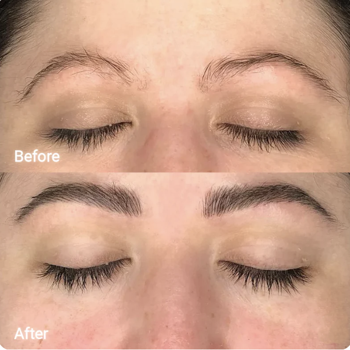 Eyebrow Regrowth 4-Session Package