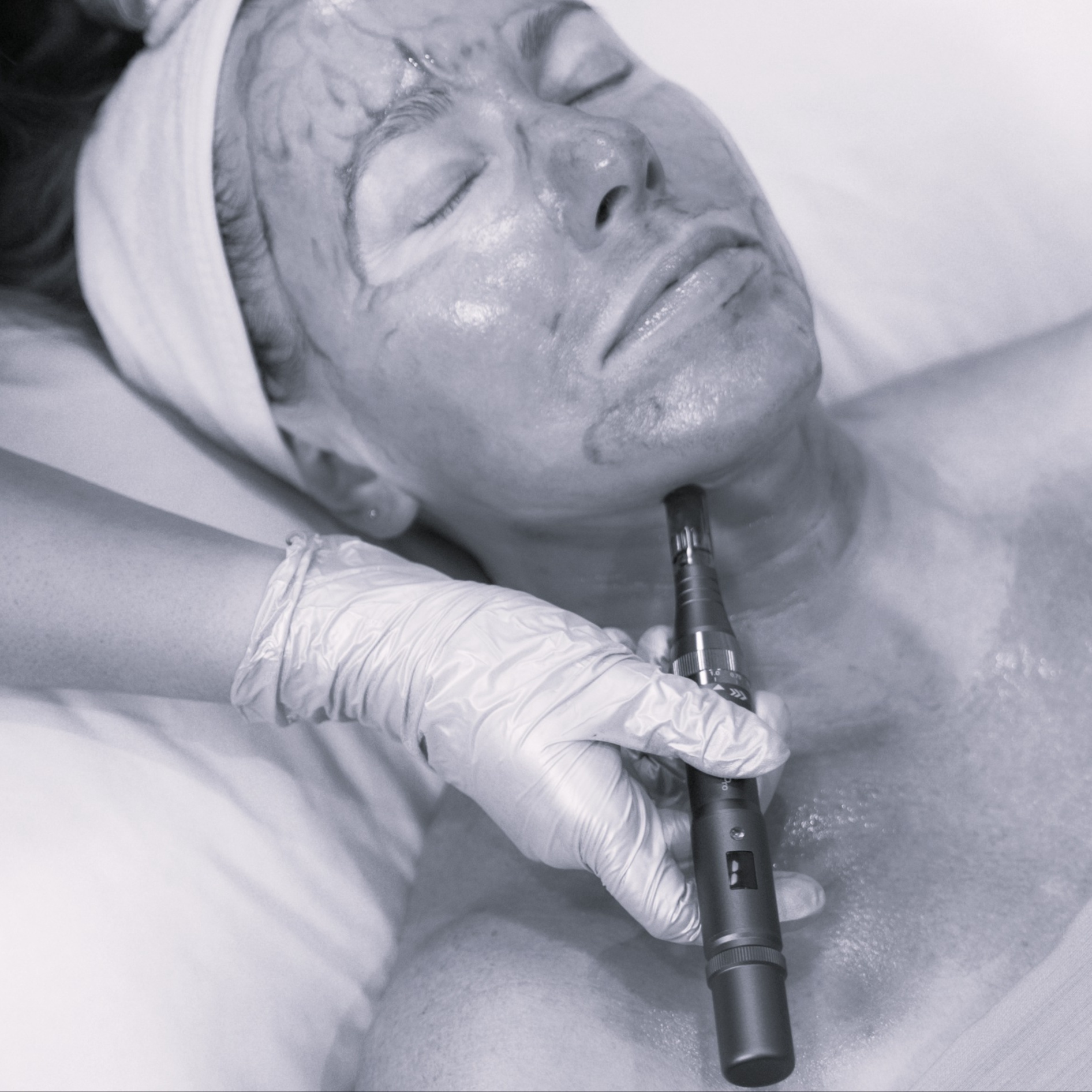 OSMOSIS FACIAL INFUSION at Wild Lotus Skincare in Santa Barbara, CA