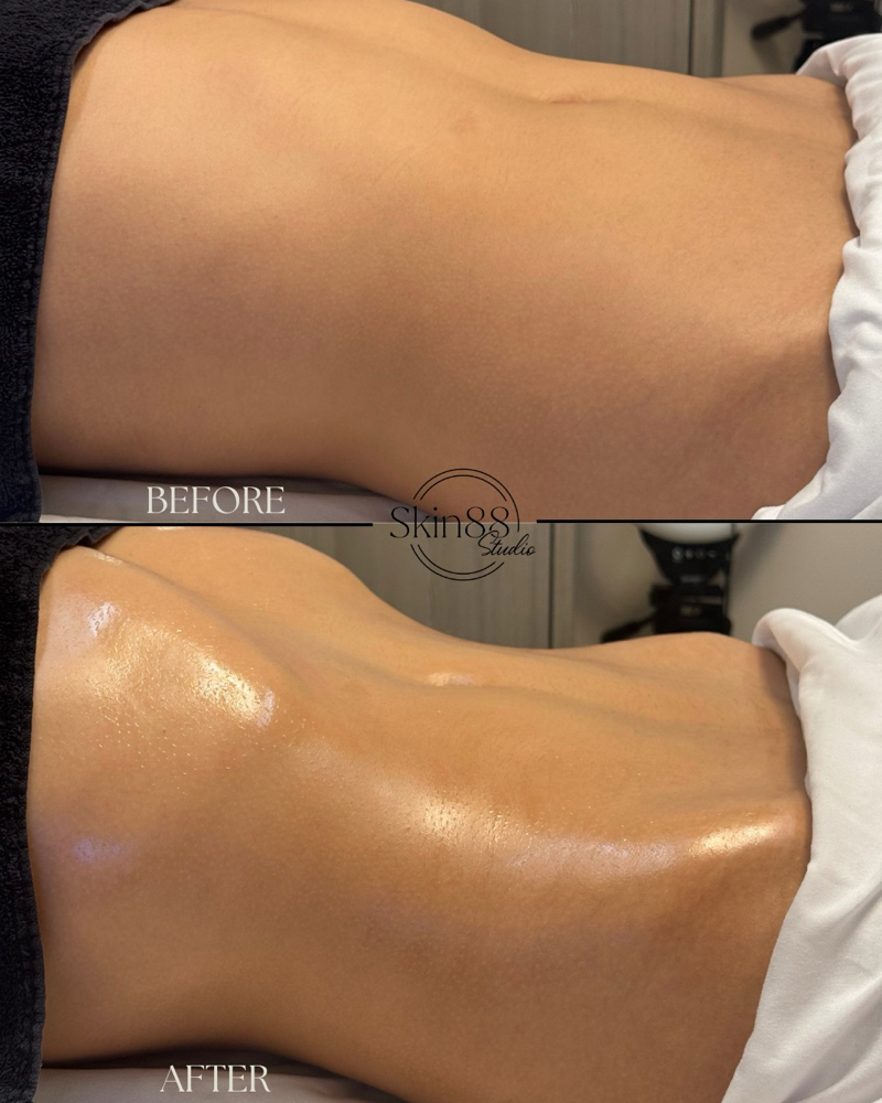 Snatch & Sculpt