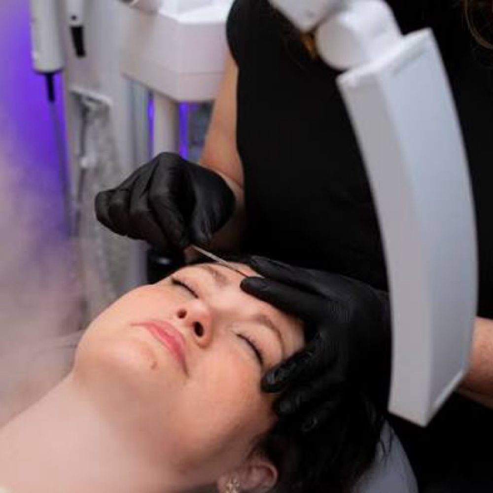 Deluxe Dermplaning at Chic Beauty House in Apollo Beach, FL