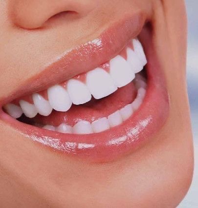 Maintenance Teeth Whitening