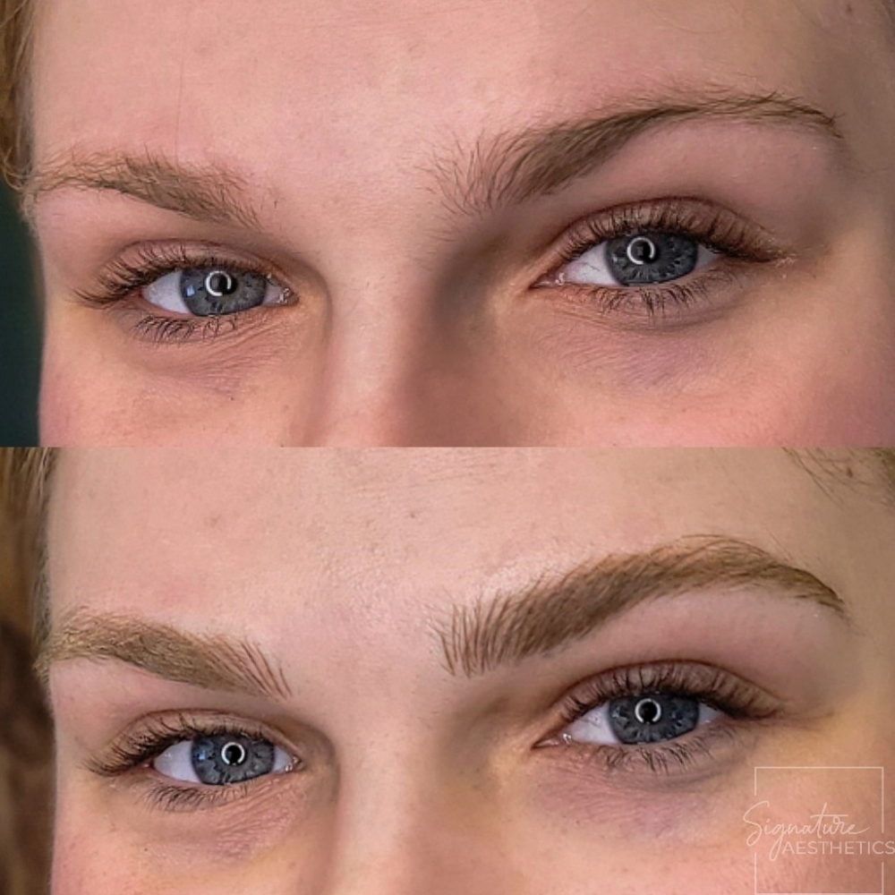 Microblading