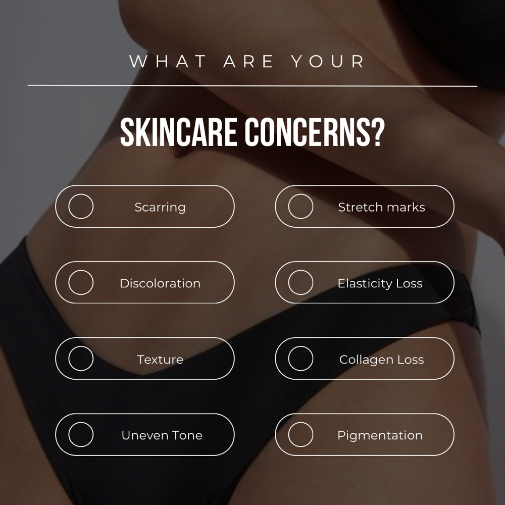 Stretch Mark/Scar Revision