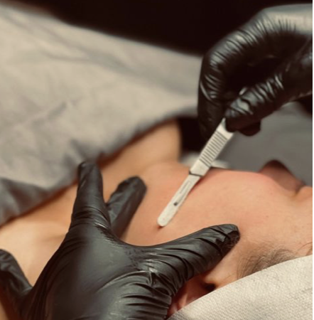 Dermaplane Add On