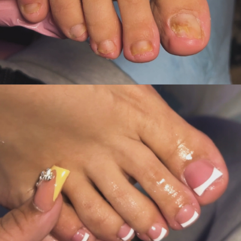 POLYGEL LIGHT FUNGAL at NailsByChachiis in Colton, CA