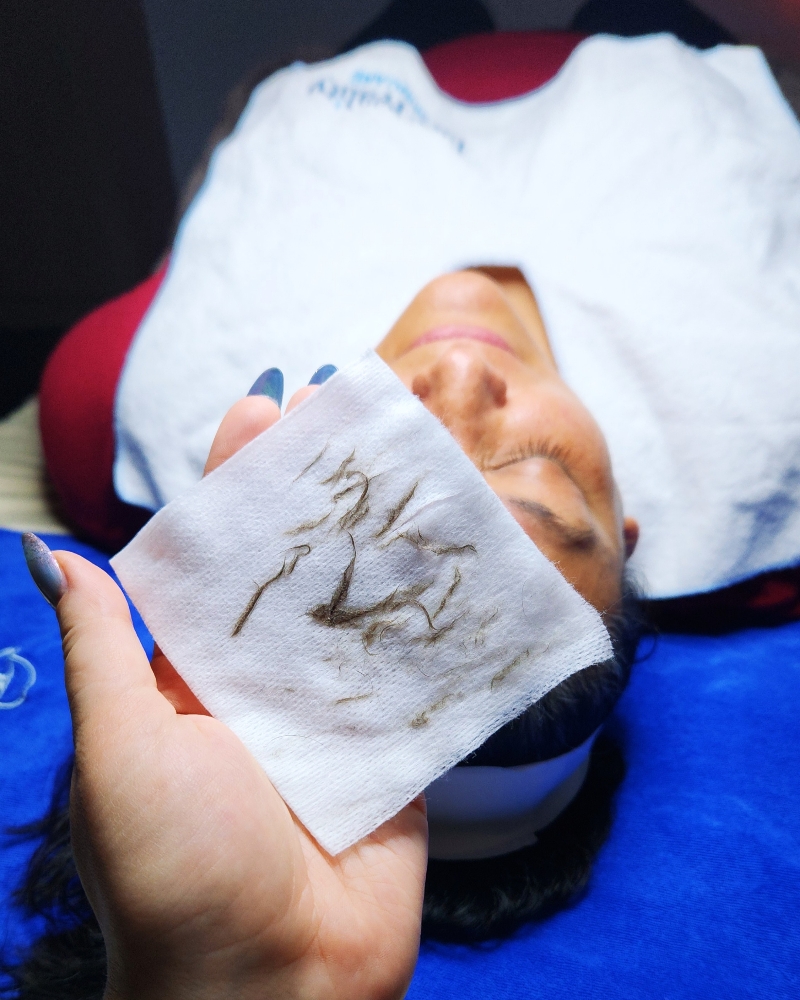 Dermaplaning (ADD ON)